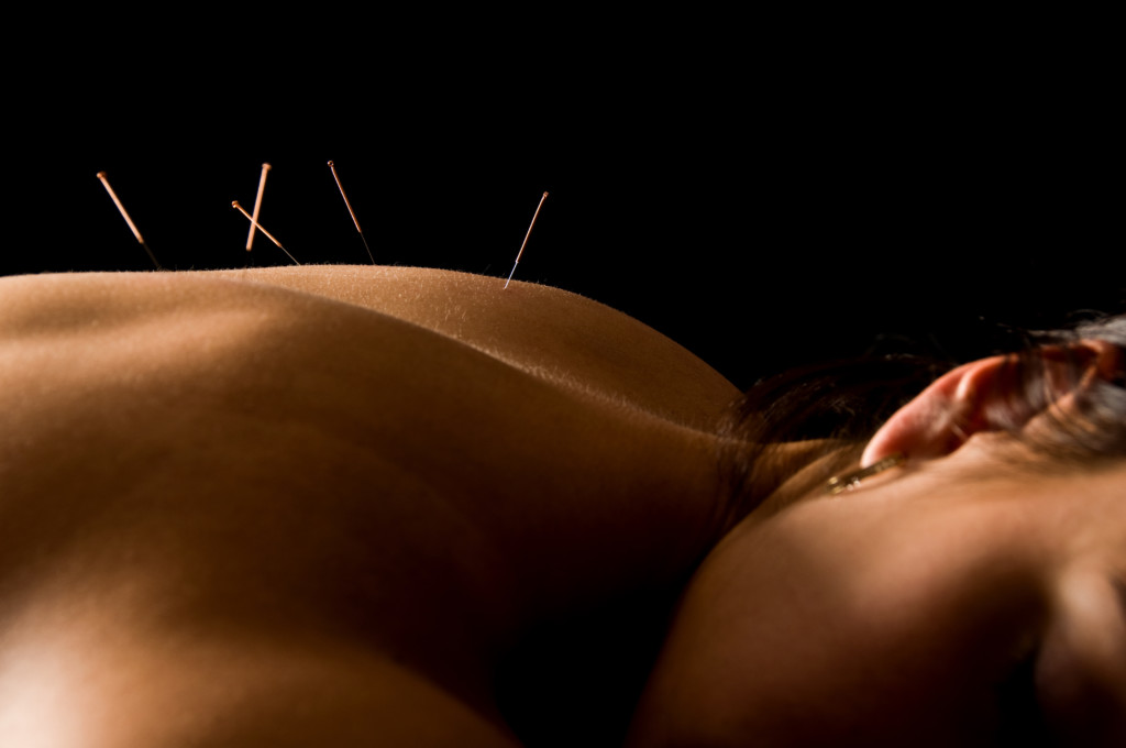 How Does Acupuncture