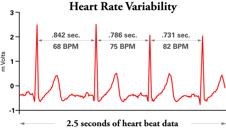 HRV measurement chart 